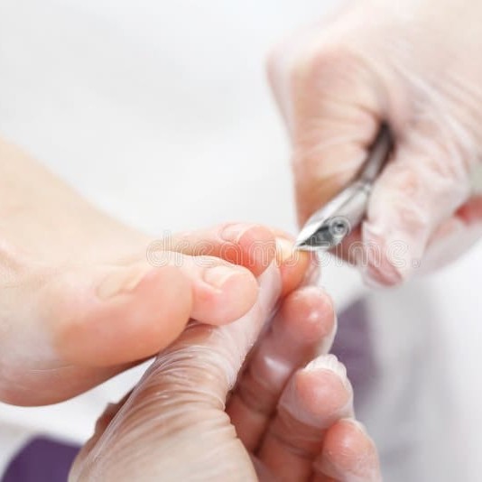 8141 Обработка ногтей