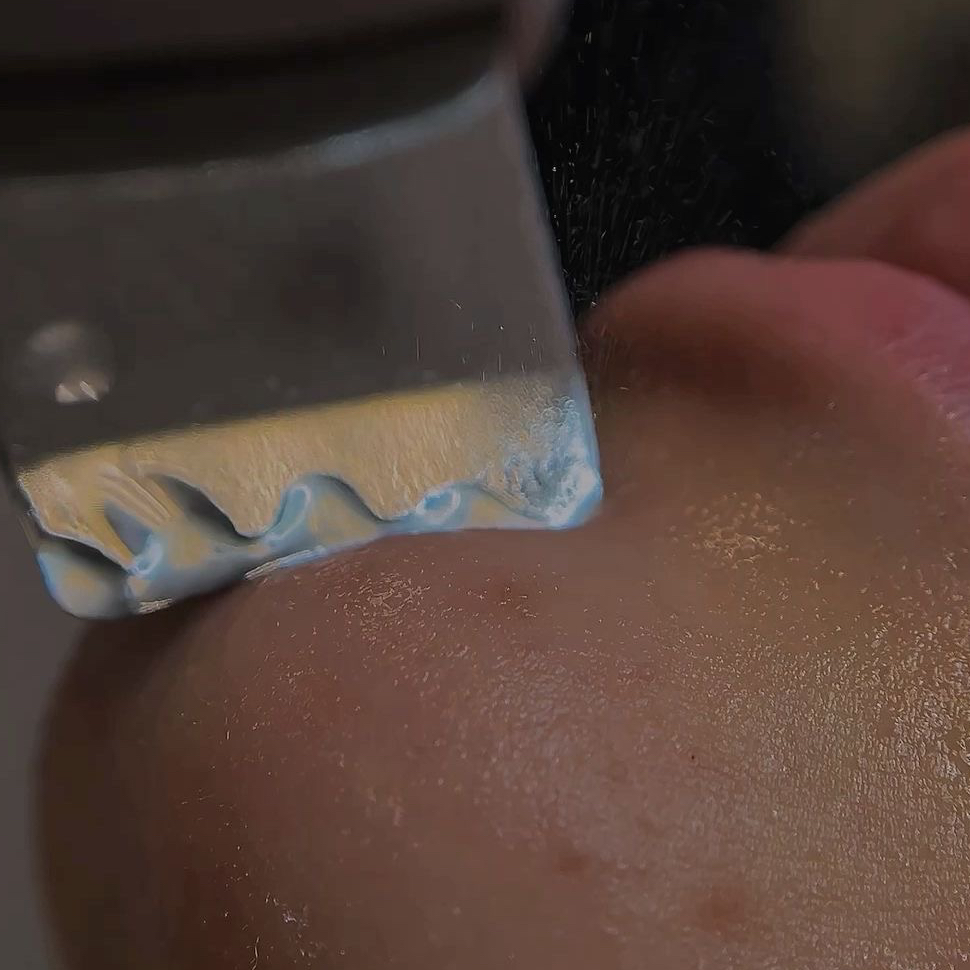 Комбинированная чистка лица/пилинг prx 33