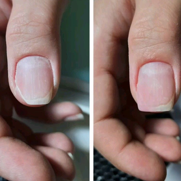 Ремонт натурального ногтя