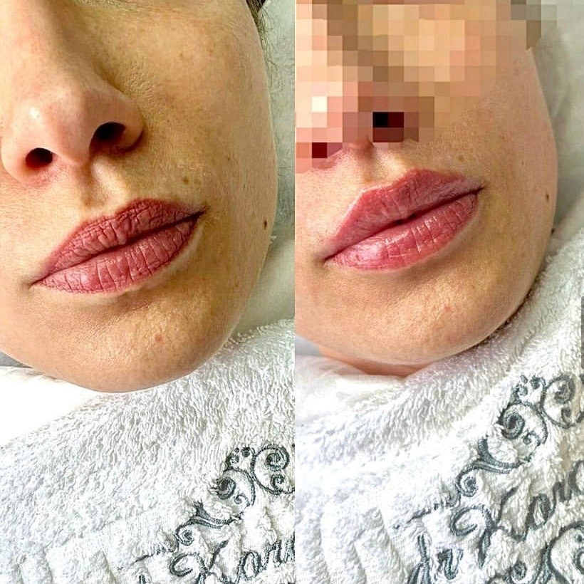 Увлажнение кожи губ (БЕЗ увеличения!)