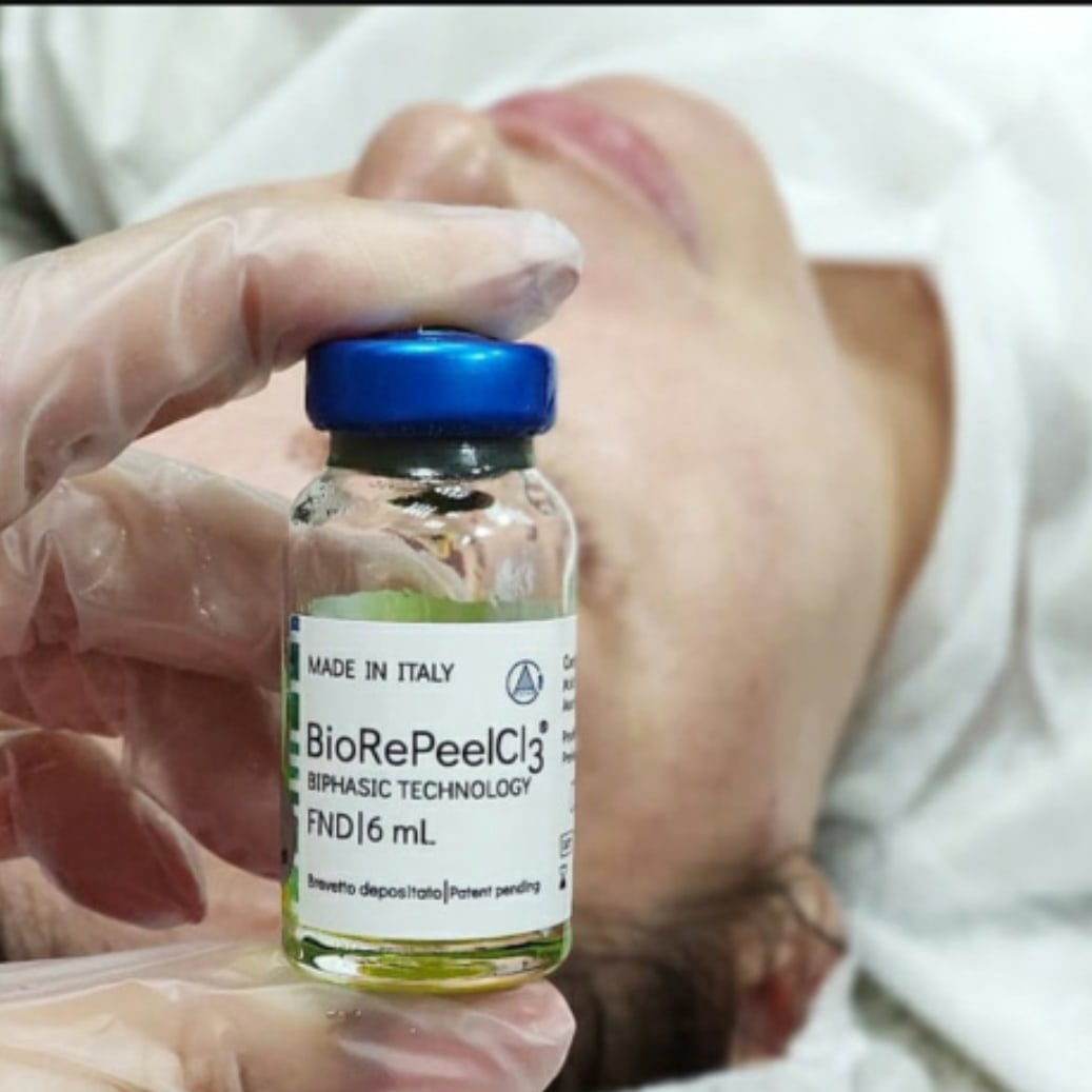 Курс пилингов BioRePeelCl3 ( 5 сеансов )