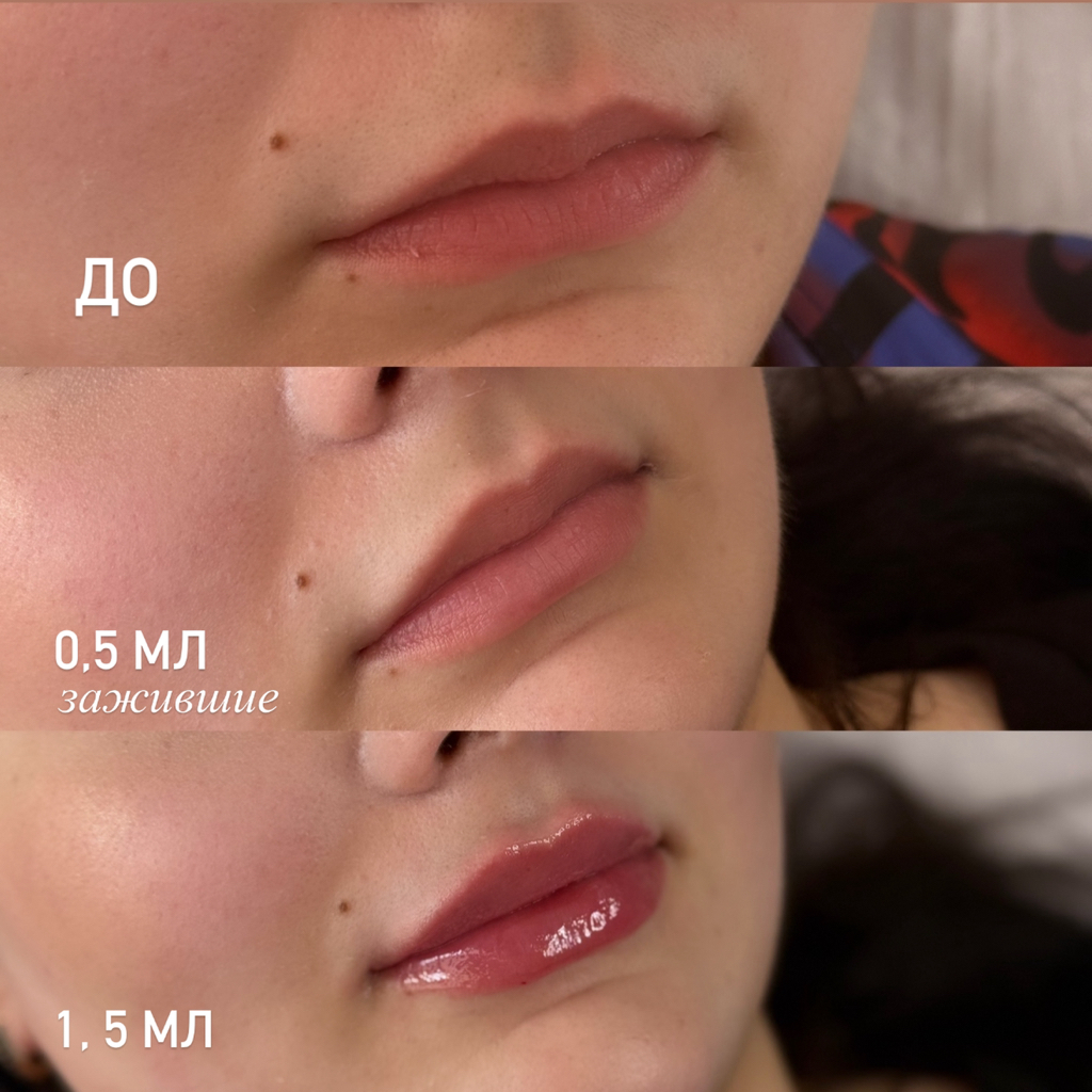 Губы 0,5