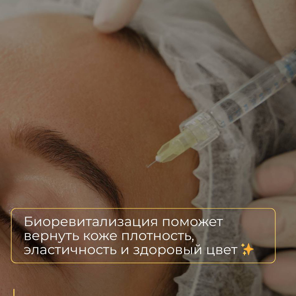 Биоревитализация  препаратом Неоколл АС10 2 мл