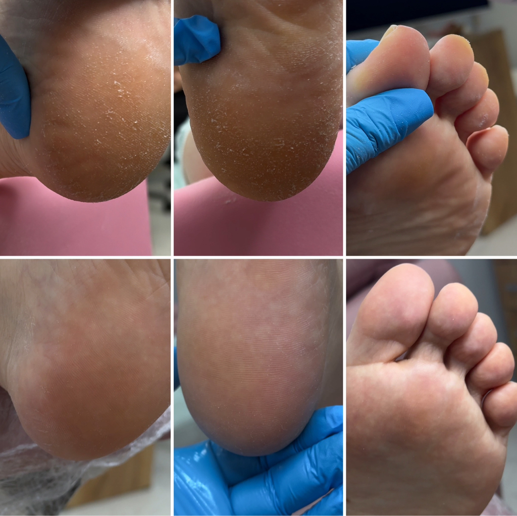 Полный педикюр без покрытия