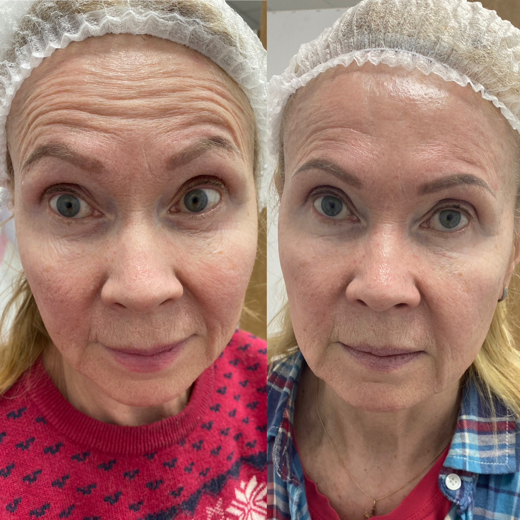 Биоревит монако-коктейль