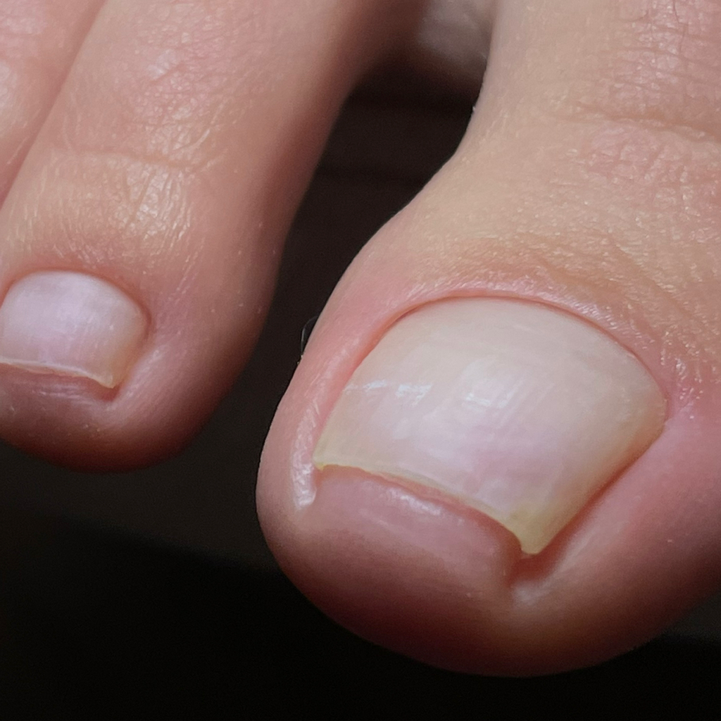 Гигиеническая обработка пальчиков без покрытия и обработки стоп