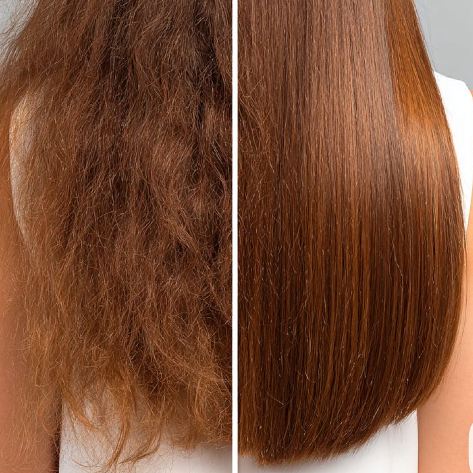 Биксипластия