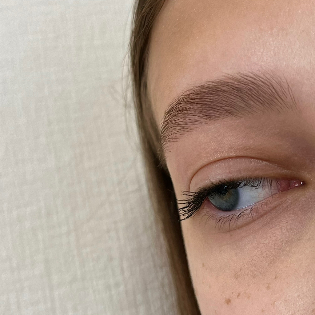 Подростковая коррекция