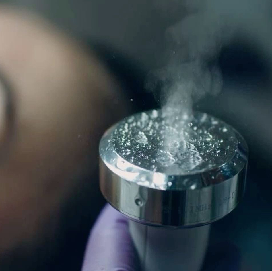 Ультразвуковой фонофорез