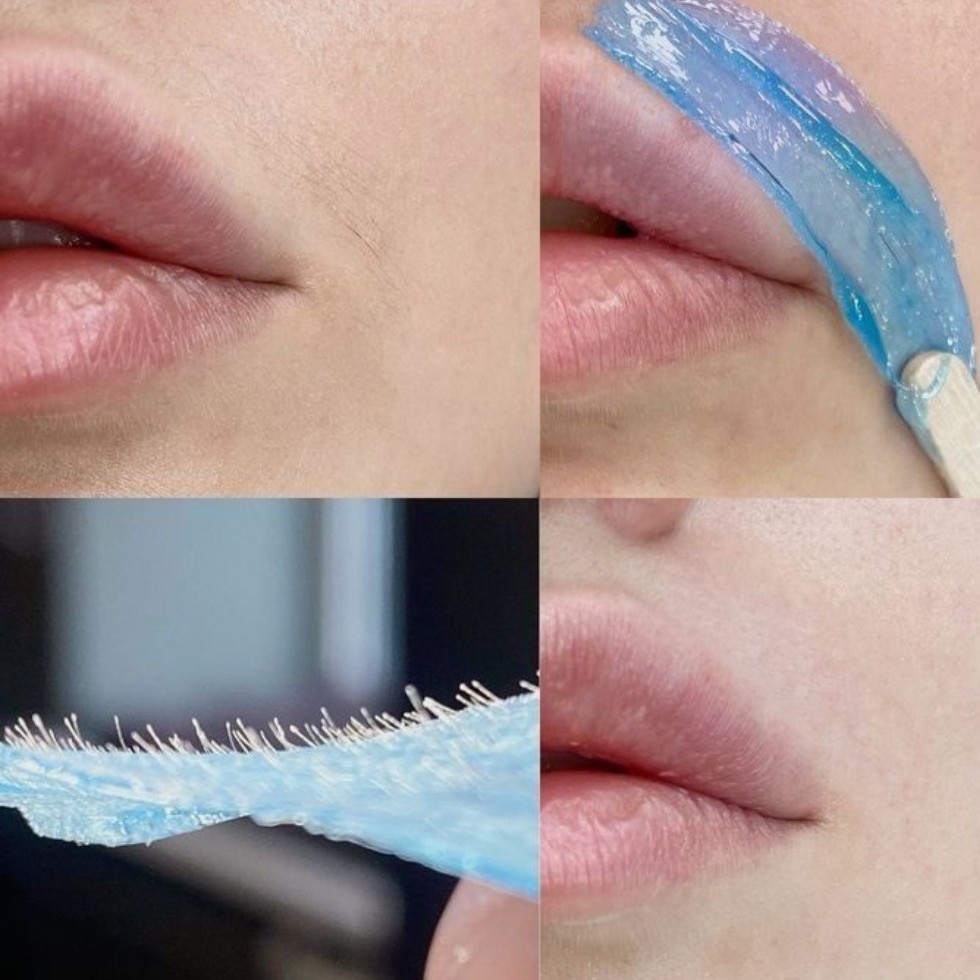 любая 1 зона на лице