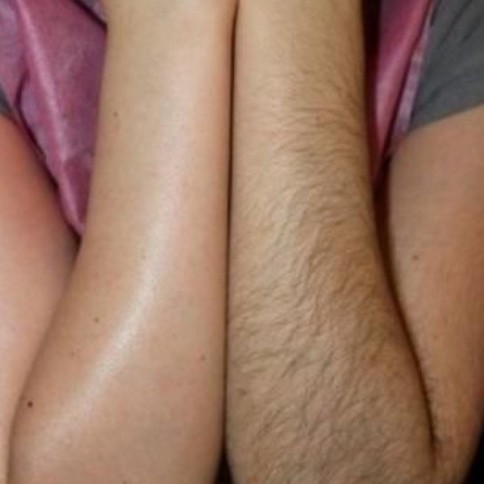 руки до логтя