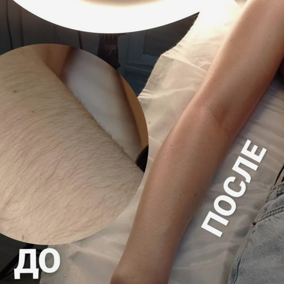 руки полностью