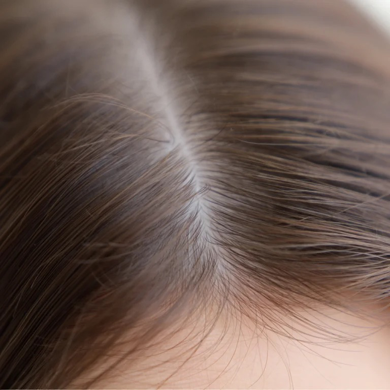 ПФО коррекция против выпадения и для роста волос Inclip