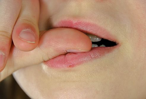 Онихофабия -грызть ногти