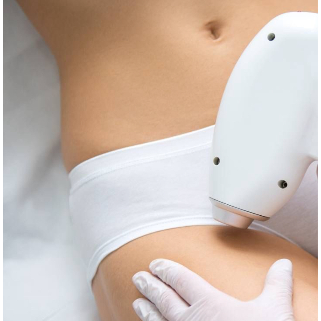 Бикини глубокое (лазерная эпиляция)