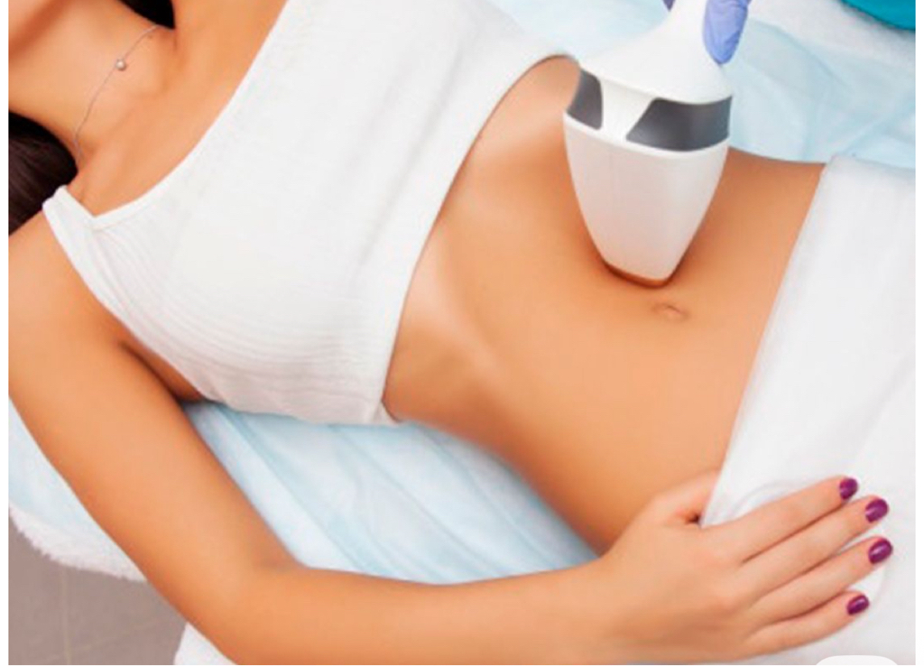 Линия на животе (лазерная эпиляция)