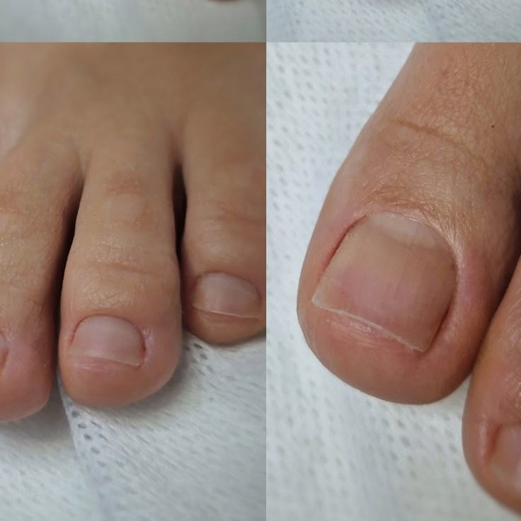 Мужской педикюр