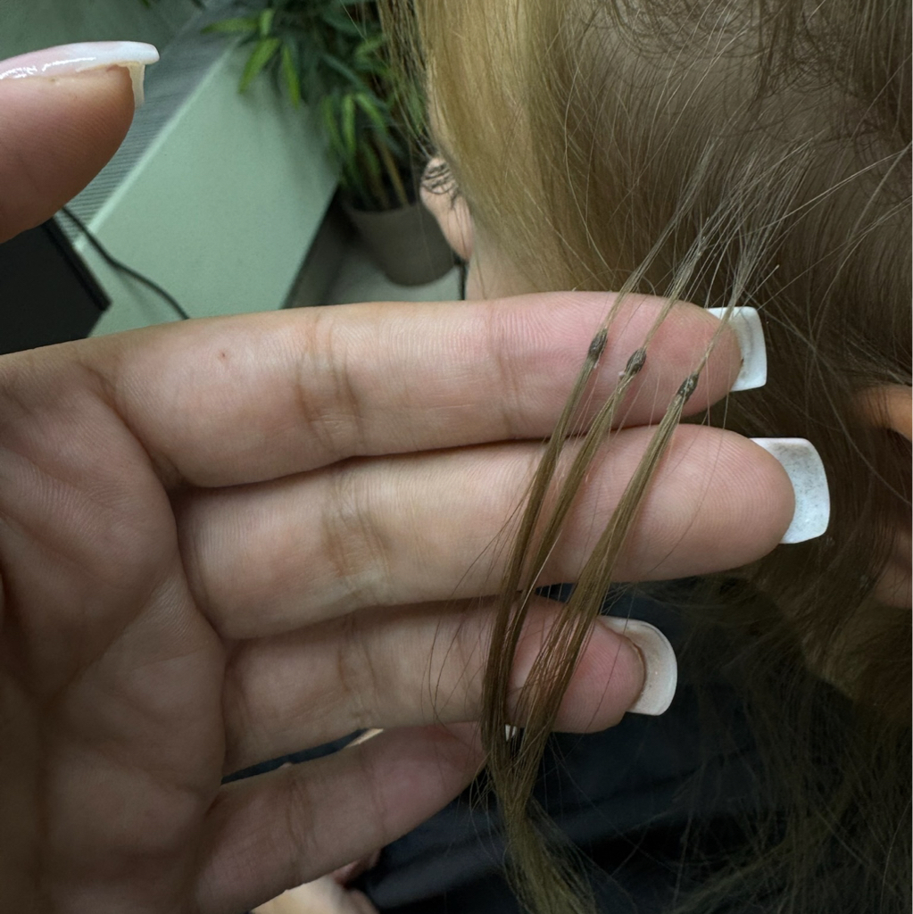 Снятие волос до 100 капсул