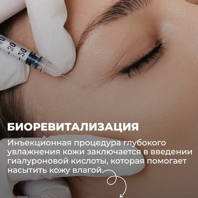 Биоревитализация препаратом Plinest fast. 2 мл