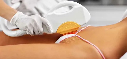 Бикини классическое