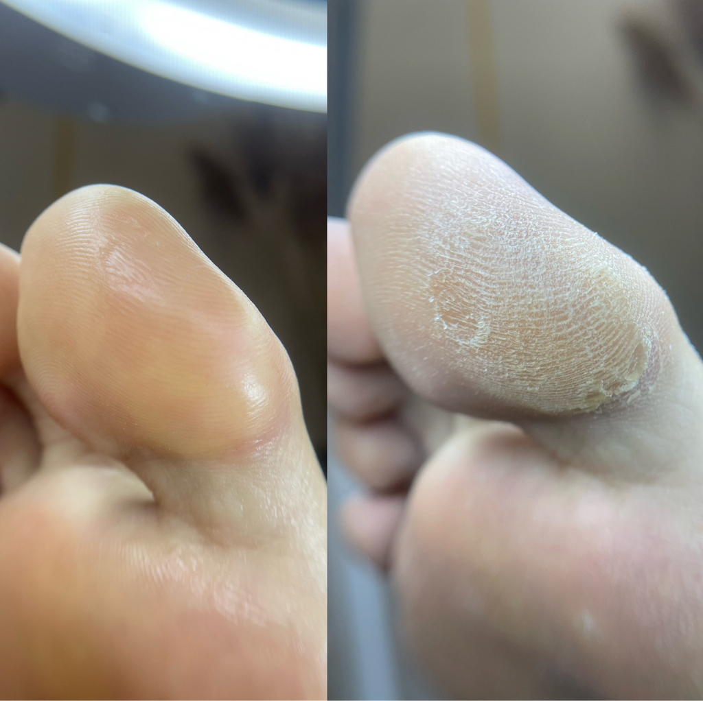 SMART педикюр (обработка стопы)