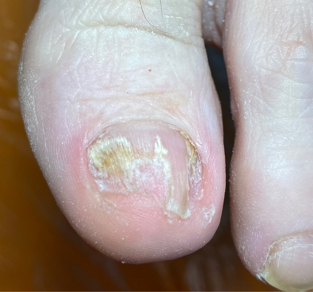 Подол-ий педикюр .