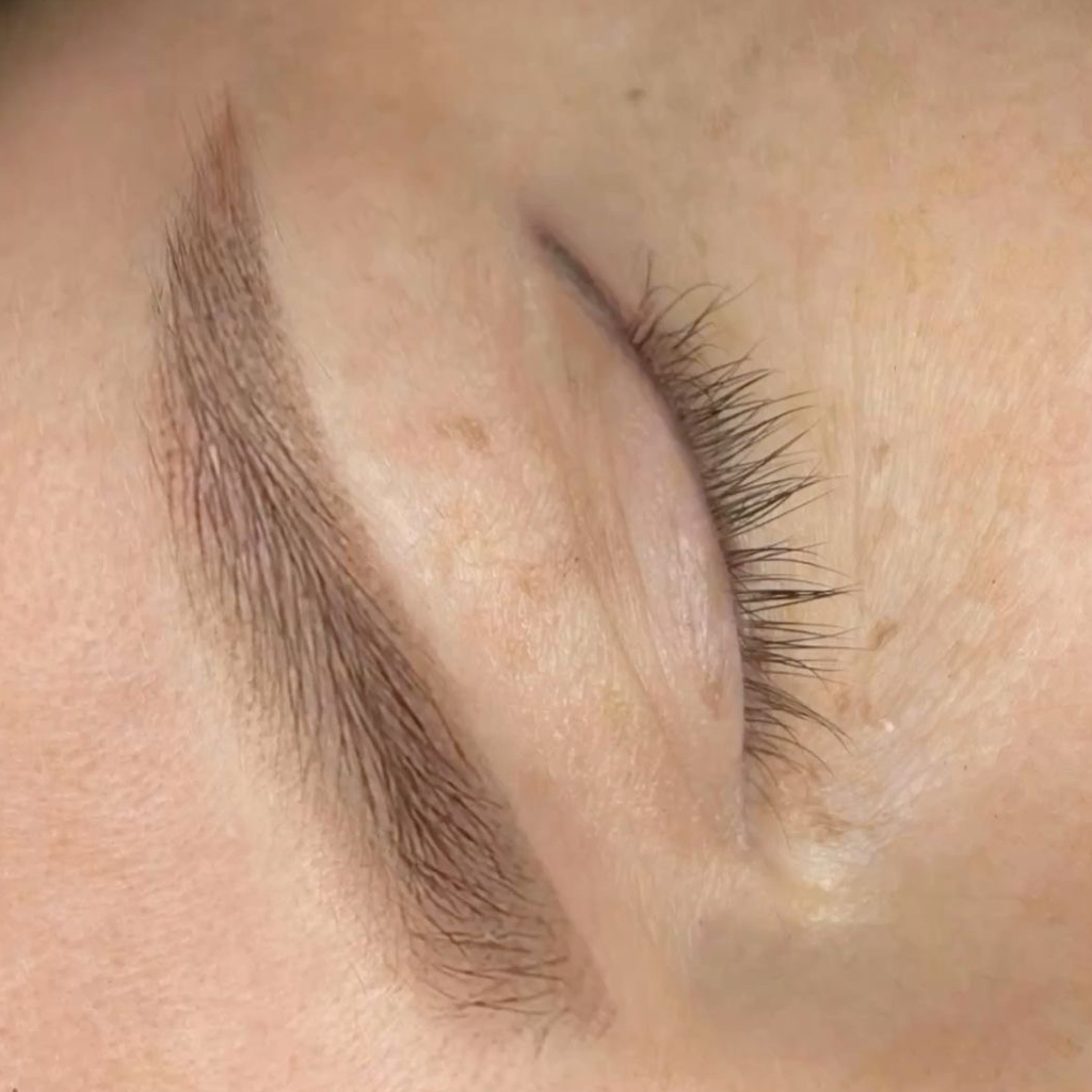 Удаление ремувером