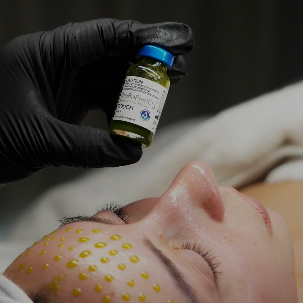 Пилинг - биоревитализант BioRePeelCl3