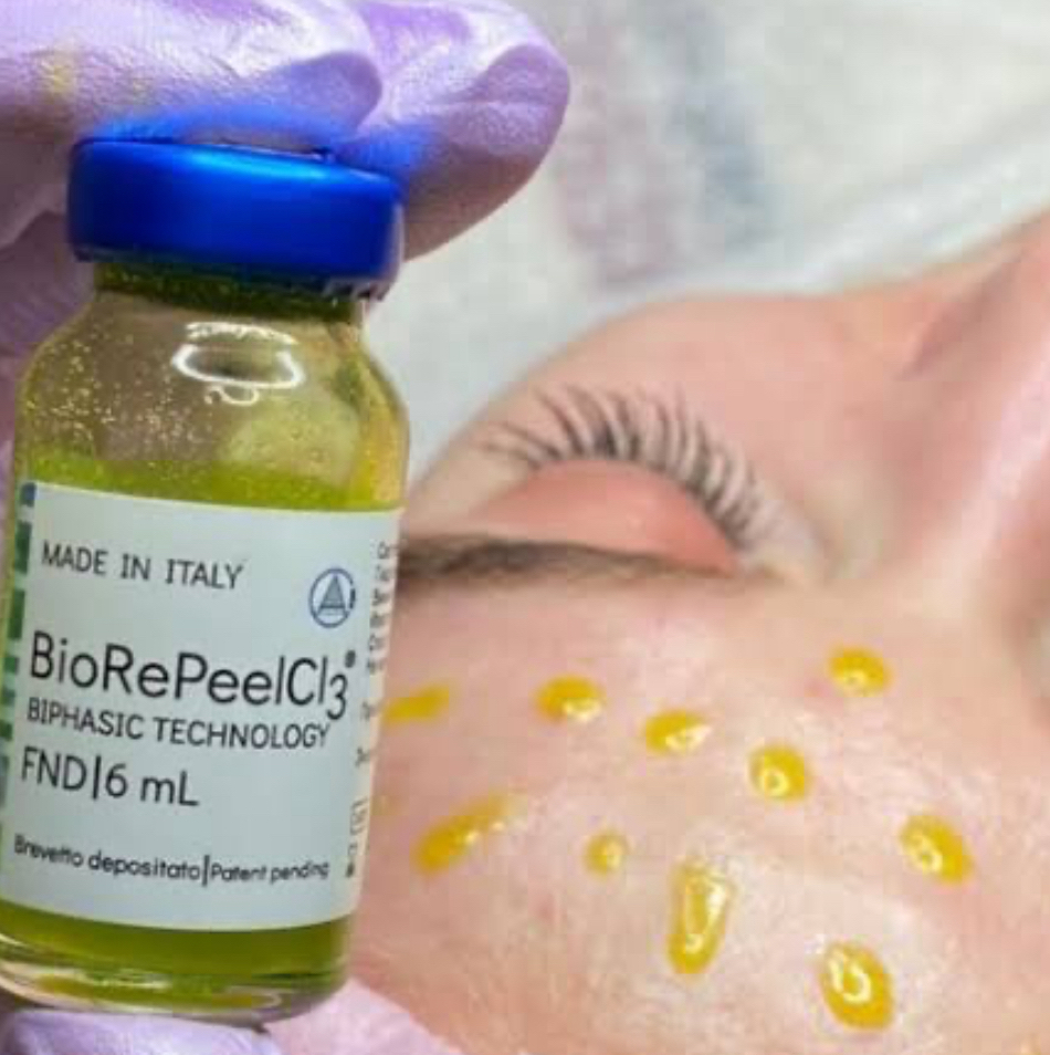 Пилинг BioRePeel