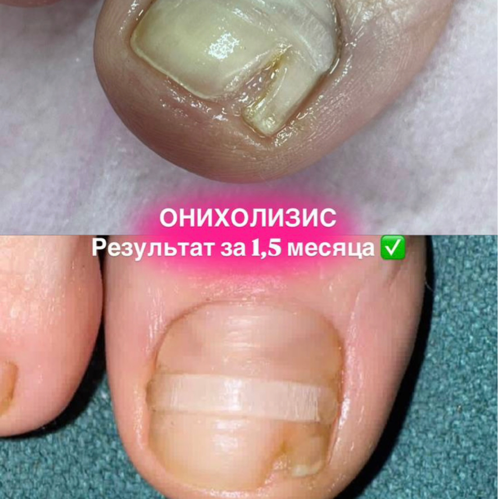 Установка Light System