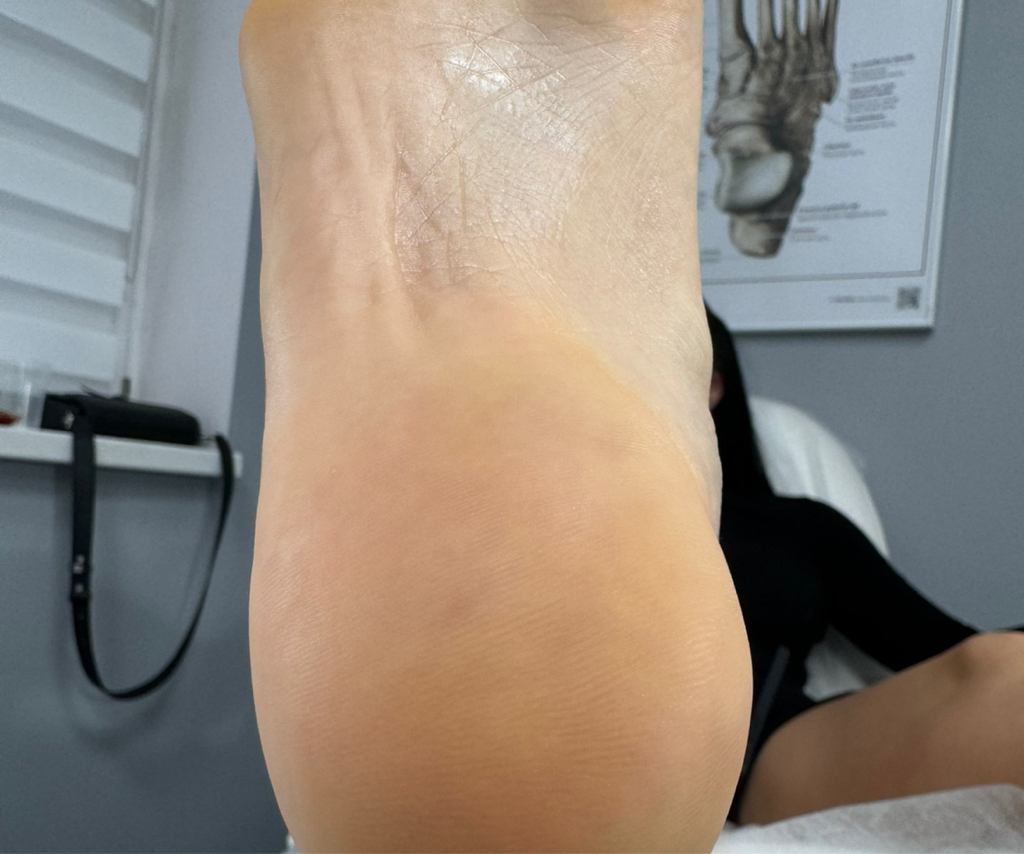 Педикюр без покрытия