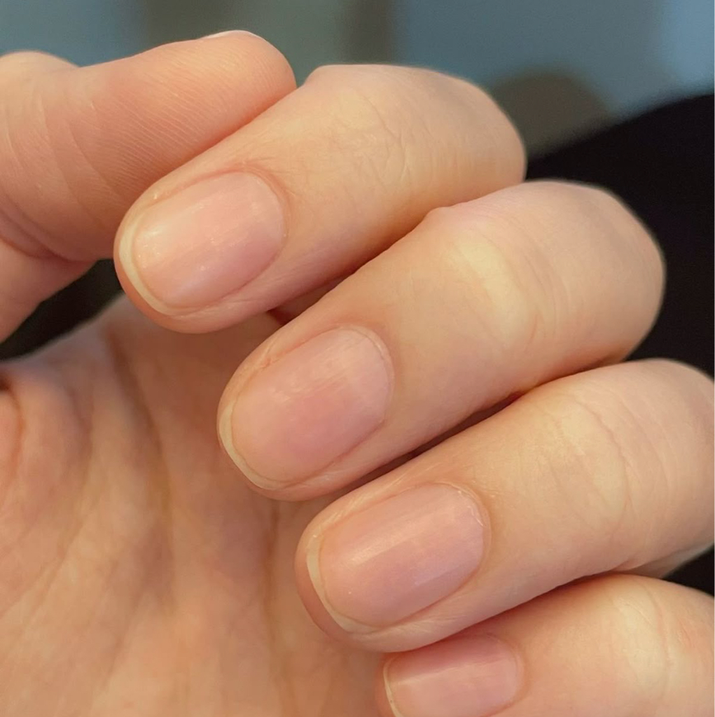 Снятие покрытия