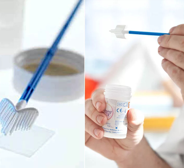 Забор материала для лабораторного анализа