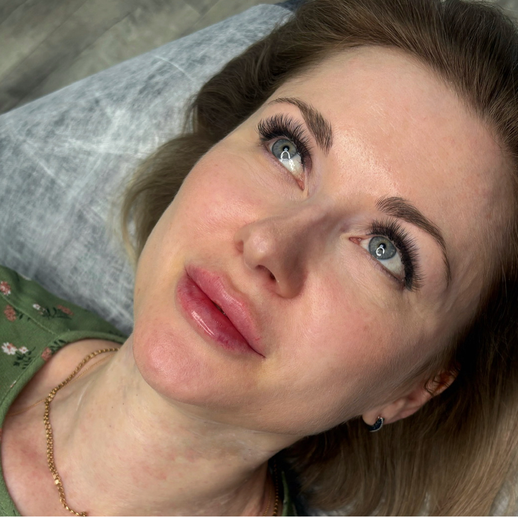 Увеличение губ