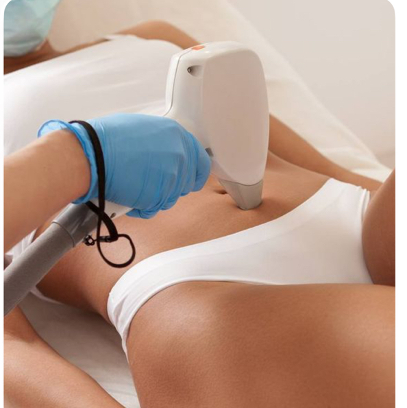 Лазерная эпиляция -Живот (дорожка)