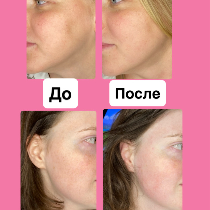 Абонемент:  8 сеансов массажа лица (скульптурный или омолаживающий)