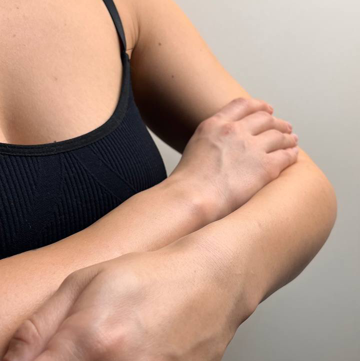 Лазерная эпиляция- руки полностью