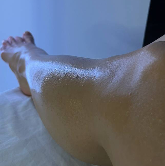 Лазерная эпиляция- голени