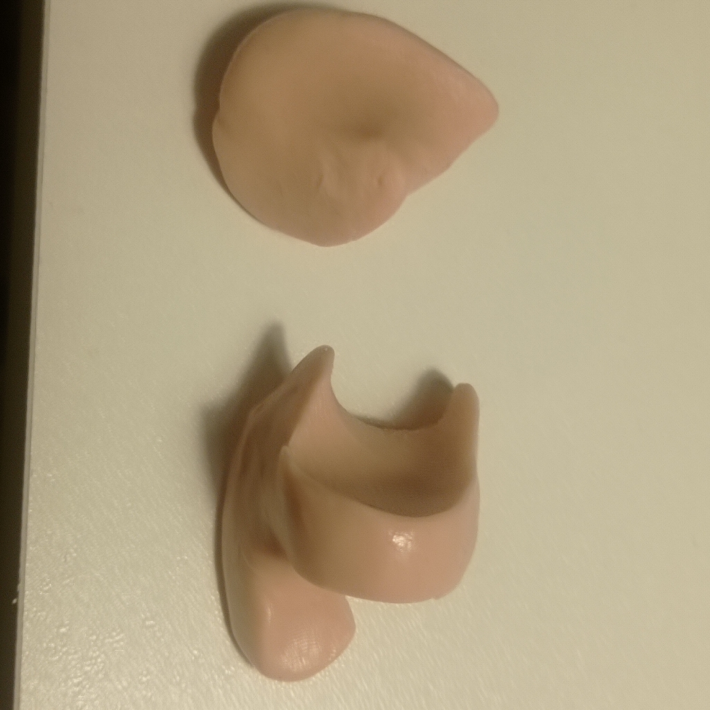 Изготовление индивидуальных ортозов