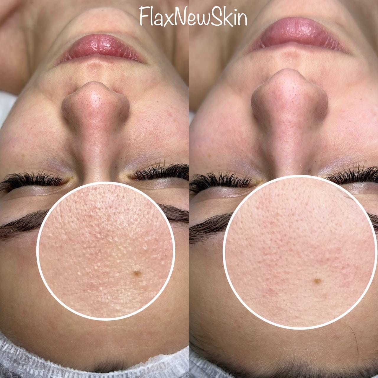 FlaxNewSkin (липосомальное обновление кожи)