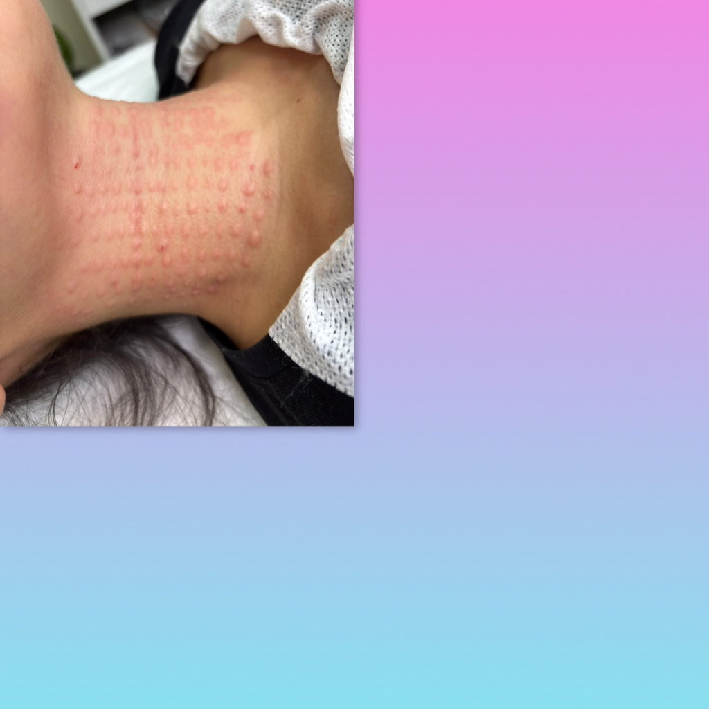 Биревитализацию Green и Silver 5.0 ml кольца Венеры