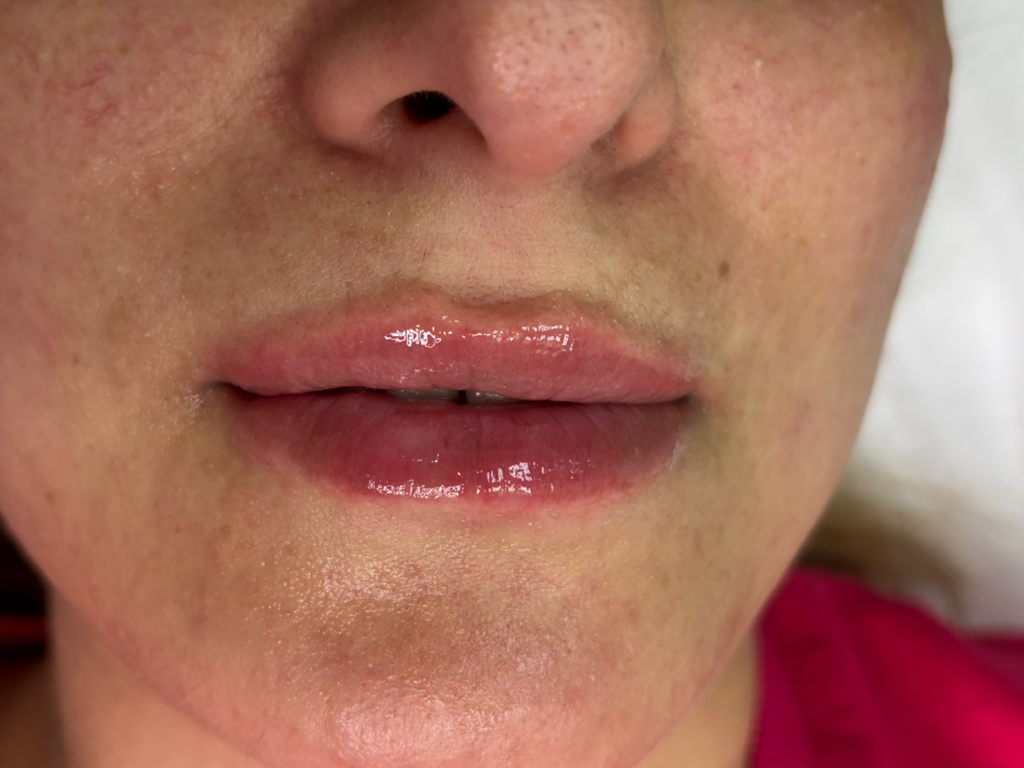 Увлажнение губ