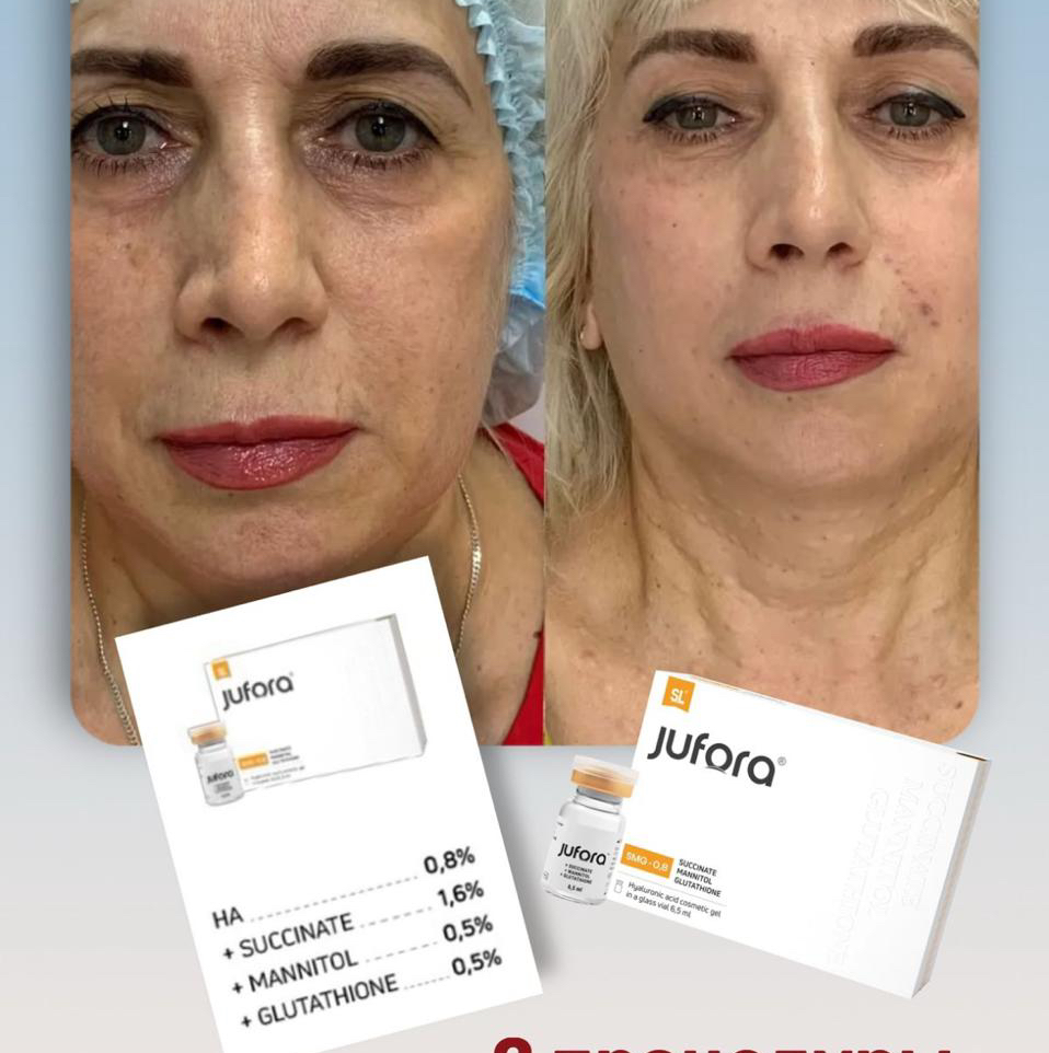 Юфора РDRN+DMAE 3.мл