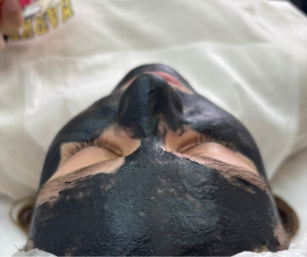 Лечение акне