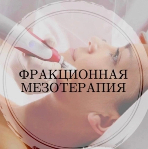 Фракционная мезотерапия проводится на лице,шее,декольте,волосистой  части головы,коже рук.