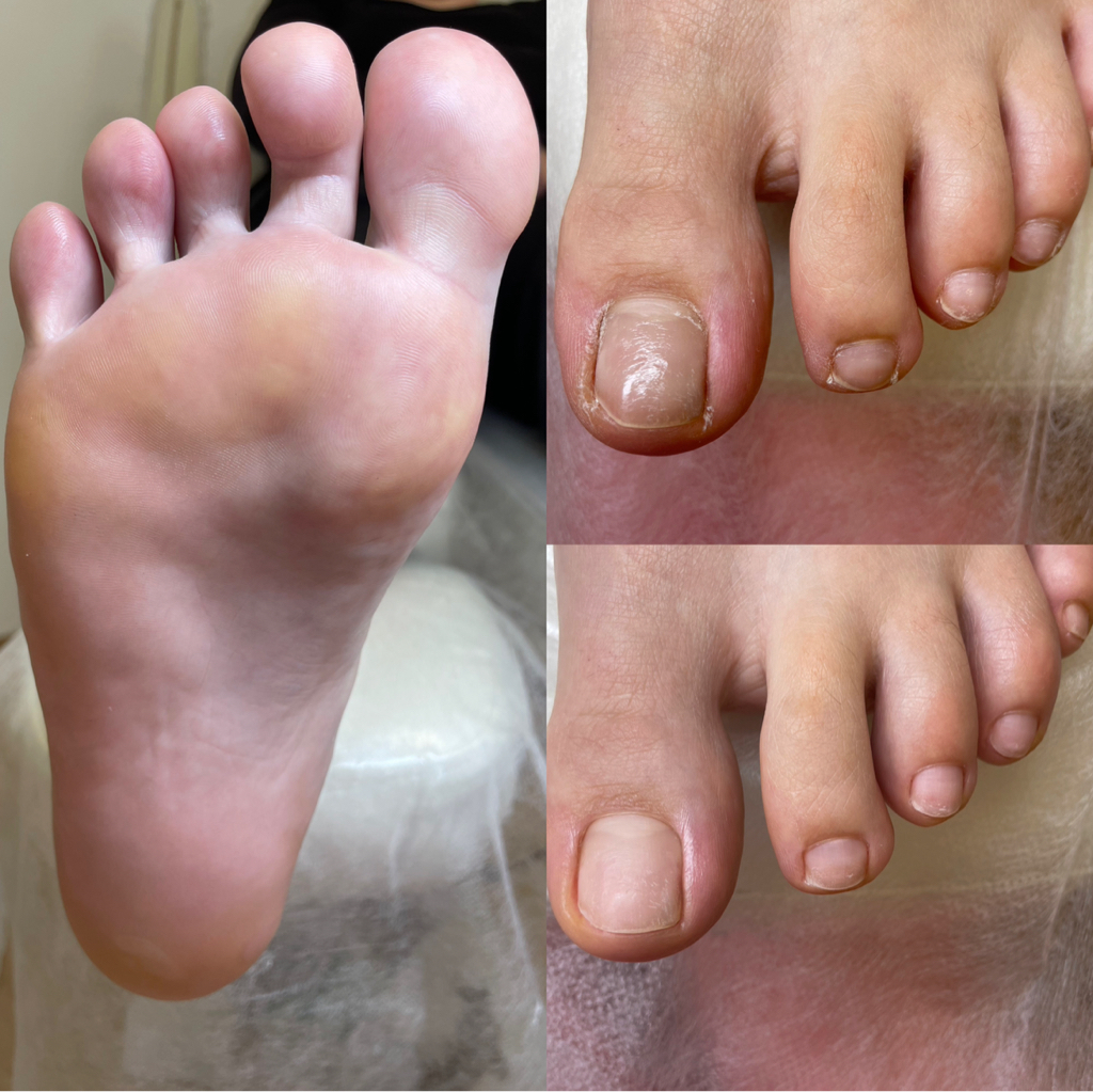 Аппаратная обработка стоп и ногтей (1 степень сложности)