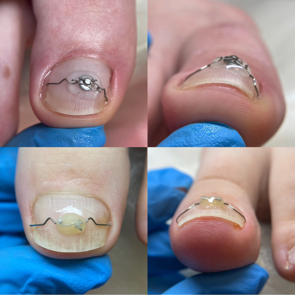 Первичная установка корректирующей системы