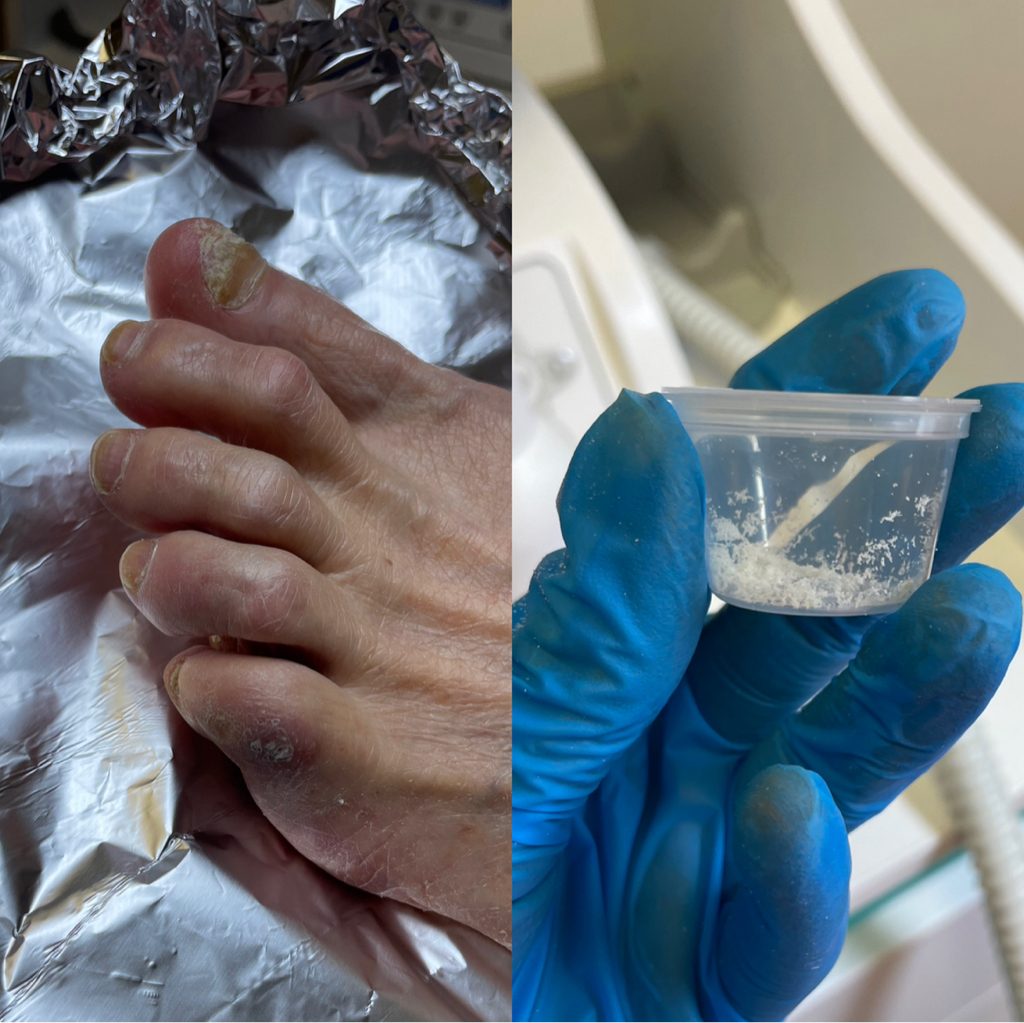 Сбор материала для анализа