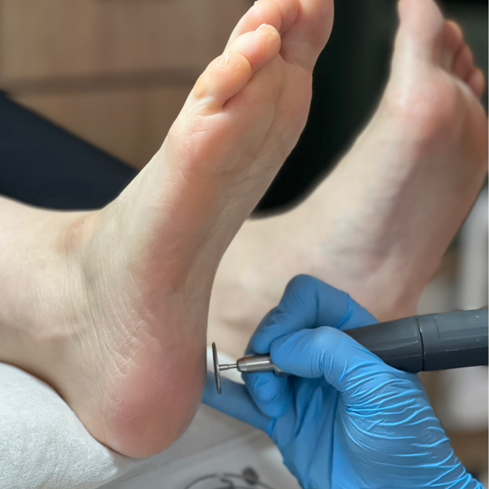 SMART обработка стоп