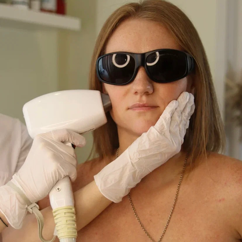 Лазер живот полностью